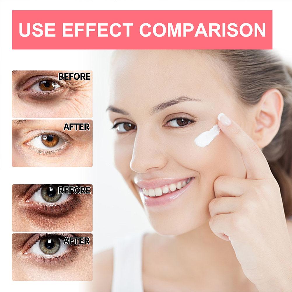 Retinol Eye Cream Lightening D - огляд і ціна The Ordinary Serum Hyaluronic Acid